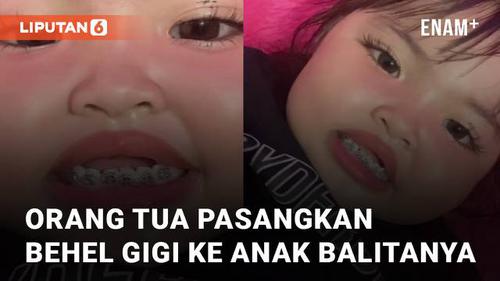VIDEO: Pasangkan Behel Gigi ke Anak Balitanya, Orang Tua Balita Ini Jadi Sorotan