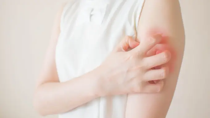 4 Cara Alami Hilangkan Jamur Membandel pada Kulit, Mudah dan Terjangkau