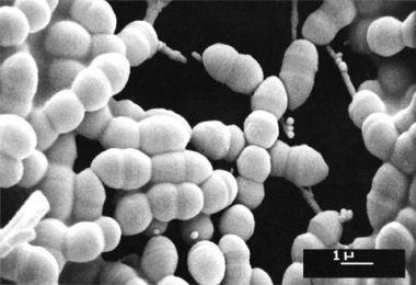 Bakteri Streptococcus Thermophilus | Foto: copyright Home.snafu.de