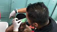 Pemain Sriwijaya FC Marckho Meraudje mendapat perawatan setelah dipukul oknum panpel Piala Gubernur Kaltim 2018. (Liputan6.com/Indra Pratesta)