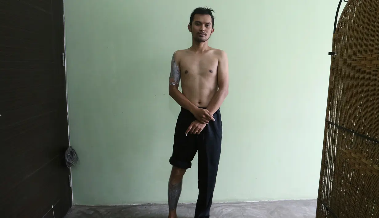 Taufiq Hidayat menunggu untuk menghapus tatonya di sebuah klinik di Tangerang (9/8). Program hapus tato ini sengaja dibuat untuk mereka yang ingin “berhijrah” dan ingin kembali lebih baik. (AP Photo/Achmad Ibrahim)