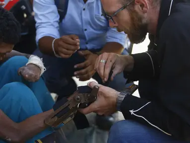 Pendiri Disaster Hack, Matthew Rockwell memasang tangan palsu buatan 3D ke lengan penderita kusta, Ram di Kathmandu (14/7). Tangan palsu yang dibuat dari mesin cetak 3 Dimensi (3D) jauh lebih murah dibandingkan tangan palsu Prostetis.(AFP Photo/Gopen Rai)