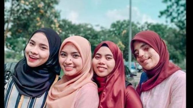 mahasiswi yang separuh wajahnya rusak