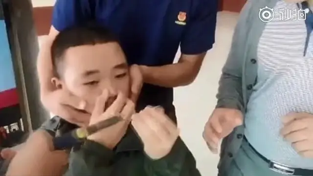 Iseng Bermain Gantungan Kunci di Hidung, Bocah Ini Akhirnya Menyesal
