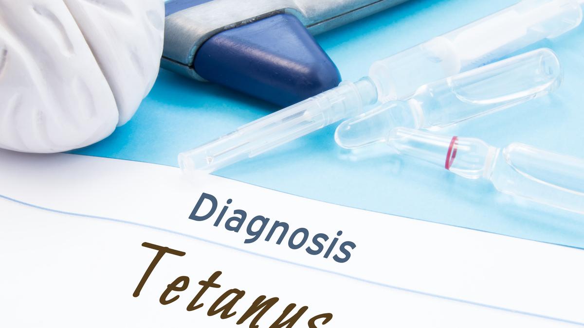 Gejala Penyakit Tetanus dan Penyebabnya, Kenali Sebelum Terlambat - Hot