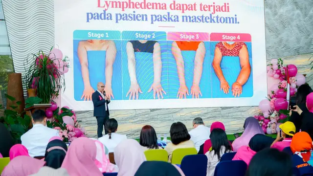 Mengenal Limfedema, Pembengkakan pada Pasien Kanker Akibat tak Berfungsinya Kelenjar Getah Bening