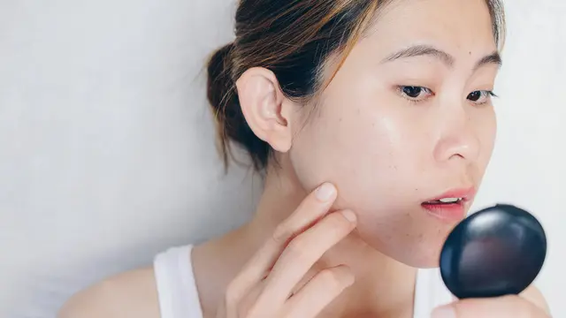 Efek Stres pada Kulit, Benarkah Bisa Merusak Skin Barrier? Cek Fakta Terbaru dan Solusi Perawatan yang Tepat