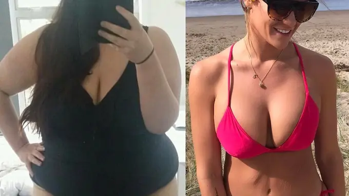 Turun 92 Kg, Ini Rahasia Diet Si Gadis Obesitas