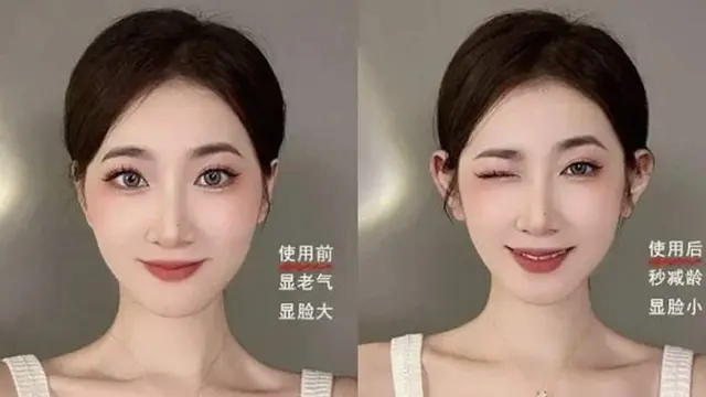 Jadi Tren, Warga China Terobsesi Jalani Operasi Telinga 'Elf' Agar Mirip Peri