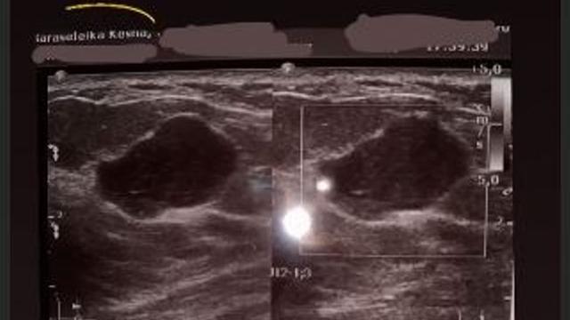 Kesha Ratuliu (Foto: Instagram/@kesharatuliu05)