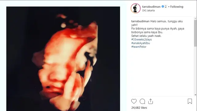 Tarra Budiman (Foto: Instagram)