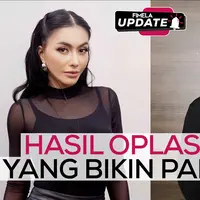 Fimela Update: Hasil Oplas Artis yang Bikin Pangling!