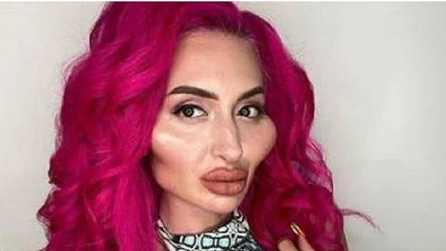 wanita filler wajah sendiri