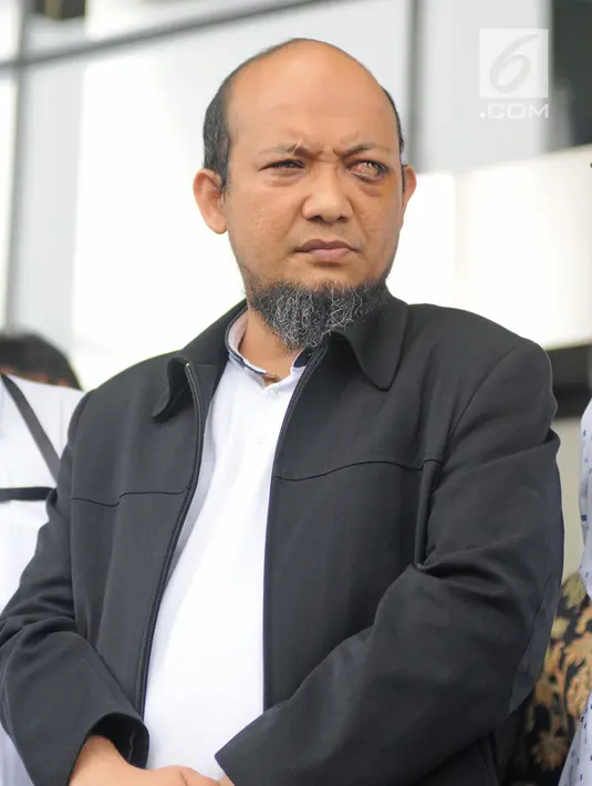 Penyidik senior KPK Novel Baswedan saat berada di gedung KPK, Jakarta, Kamis (22/2). Sebelumnya Novel Baswedan disiram air keras saat pulang salat berjamaah pada subuh 11 April 2017. (Liputan6.com/Herman Zakharia)