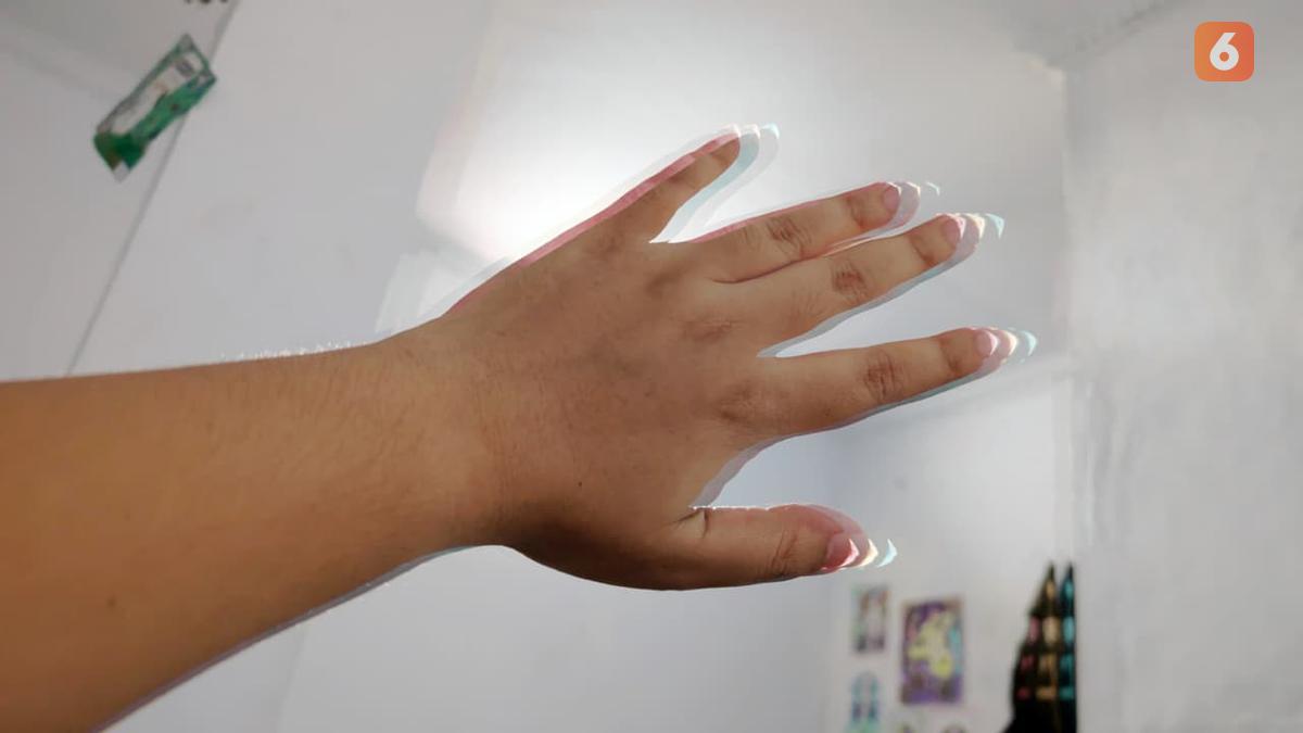 Gejala Khas Parkinson: Tremor Muncul Saat Istirahat atau Tubuh dalam Kondisi Diam