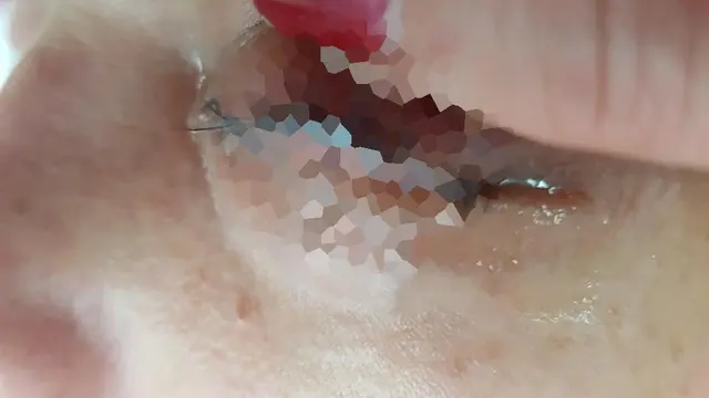 Sambung Bulu Mata di Salon Murah, Wanita Ini Nyaris Buta