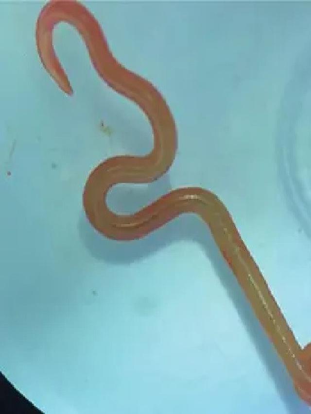 Cacing parasit Ophidascaris robertsi.