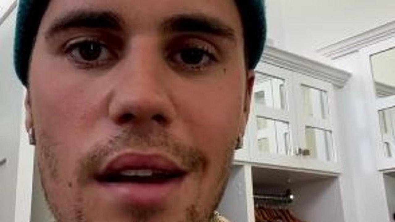 Justin Bieber sebut dirinya menderita Ramsay Hunt Syndrome