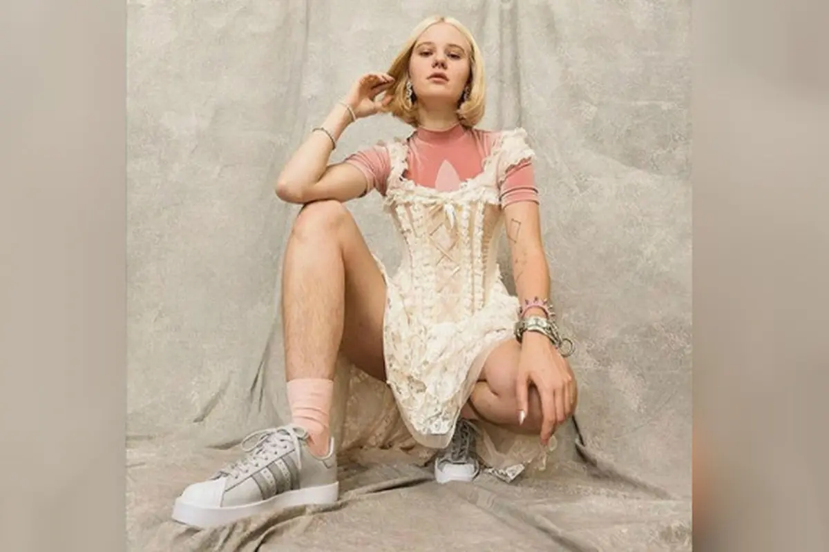 Arvide Bystrom, model cantik berbulu kaki asal Swedia (Instagram/@arvidabystrom)