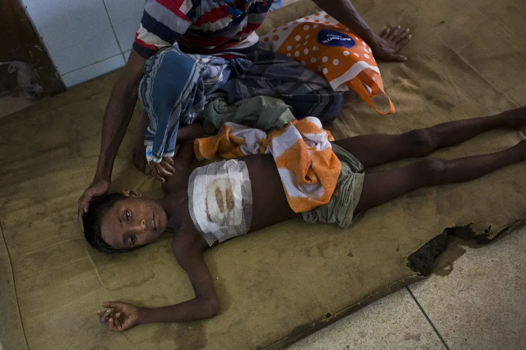 Shoabib, anak Abu Tahir, bocah Rohingya yang mengaku terkena peluru yang ditembakkan oleh militer Myanmar, tengah mendapat perawatan di rumah sakit di Cox Bazar, Bangladesh (AP)