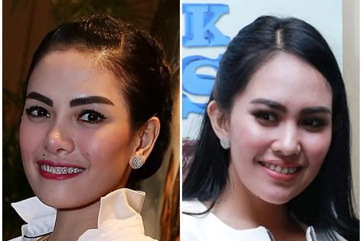 [Bintang] Nikita Mirzani dan Kartika Putri