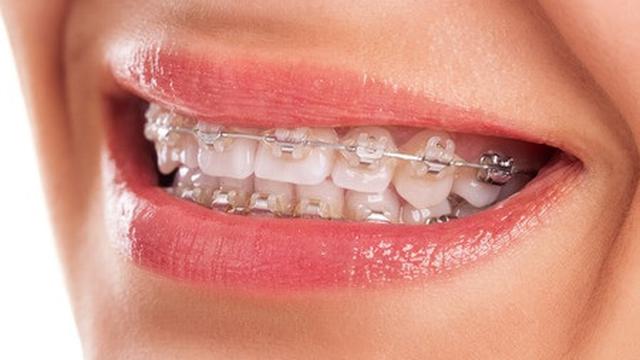 Hukum scaling gigi bulan puasa