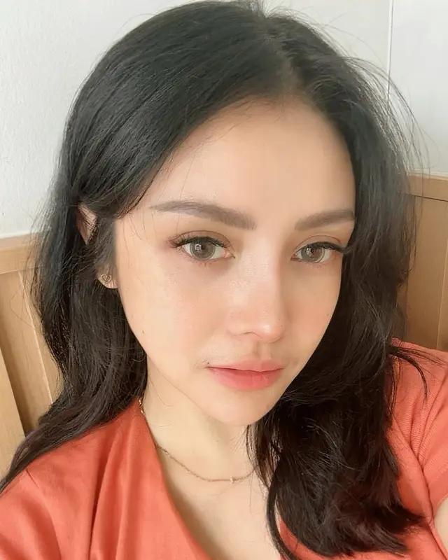 6 Potret terbaru Mawar AFI usai operasi plastik habiskan Rp521 Juta 