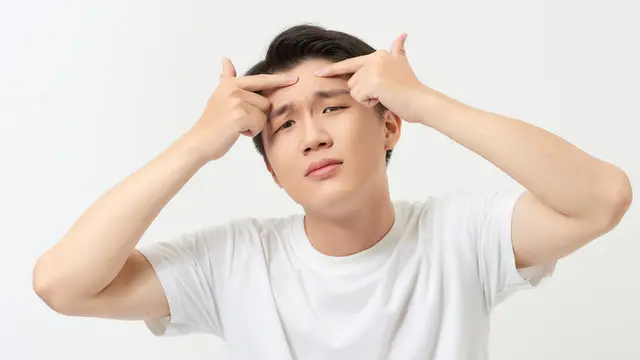 Jerawat di Dahi Pria, Ternyata Ini Penyebab dan Cara Mengatasinya