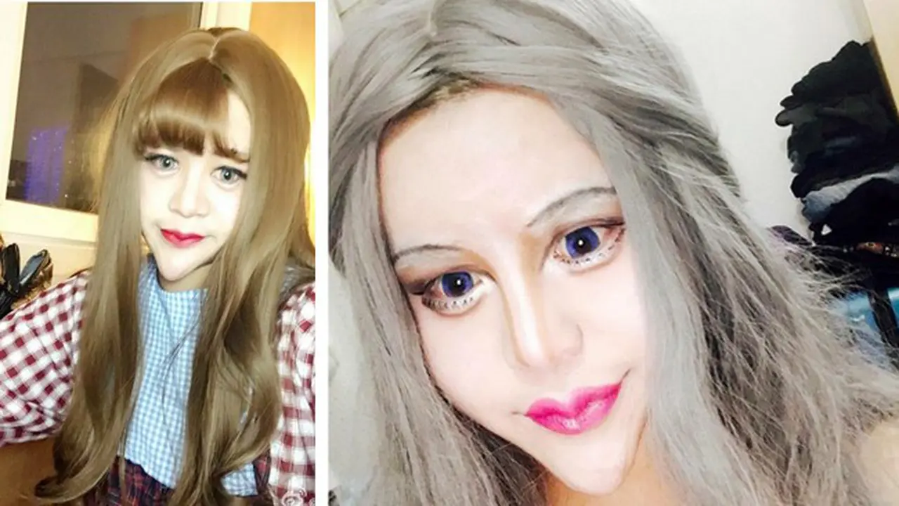 Habis Oplas, Gadis Ini Ngaku Paling Cantik Sedunia, Sepakat?