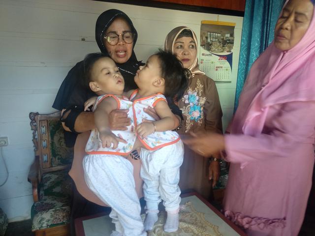 Perjalanan Bayi Kembar Siam Aqila Azila Hingga Pulang Ke Kendari Surabaya Liputan6 Com