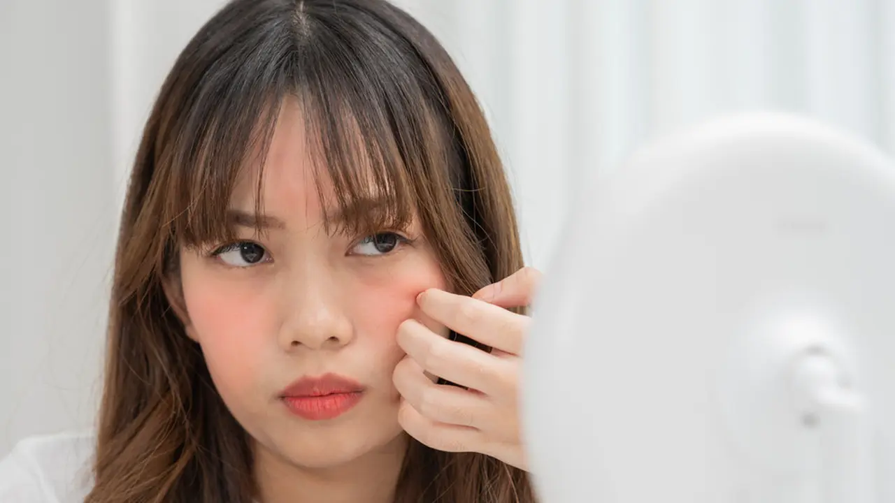 How To: Menenangkan Kulit Wajah Kemerahan Menurut Anjuran Ahli Dermatologi, Ternyata Praktis Kok!