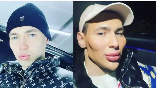 Ketagihan Operasi Plastik, Mantan Tentara Rusia Ubah Wajahnya Jadi Mirip Alien