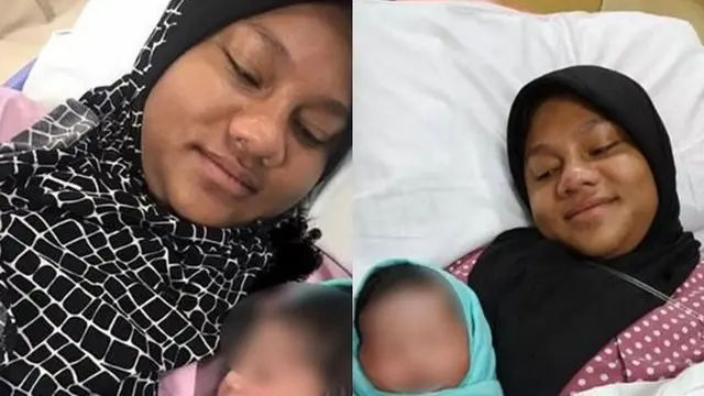Viral, Wajah Wanita Ini Mendadak Berubah saat Hamil