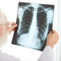 Kenali bahaya pneumonia dengan membaca penyebab dan cara pencegahannya, agar kita terhindar dari bahaya yang akan ditimbulkan oleh penyakit ini. (Sumber: Freepik/pressfoto).