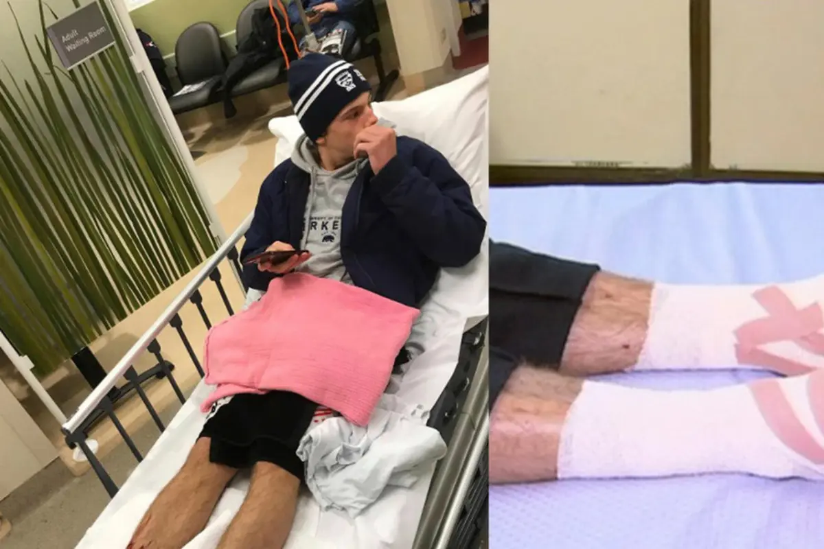 Apa Itu Kutu Laut yang Gerogoti Kaki Remaja Australia?