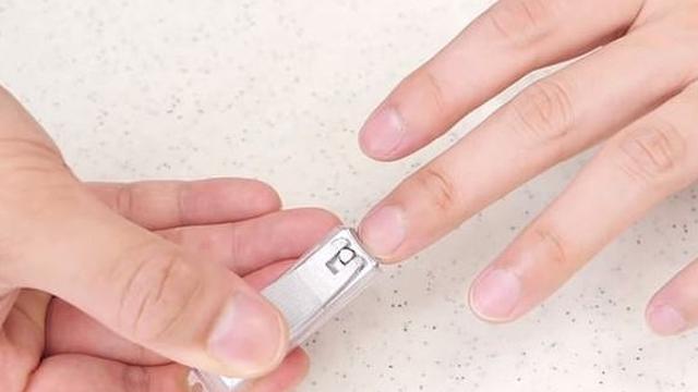 Ingin Lamar Kekasih, Pria Ini Buat Cincin Pertunangan Dari Bagian Tubuhnya