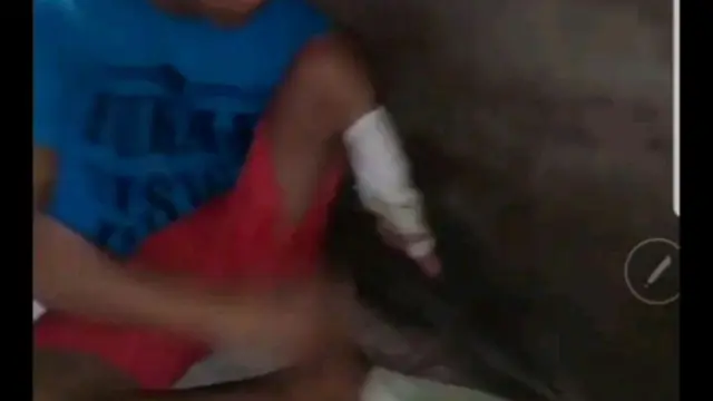 Video pelajar SD di Kabupaten Luwu Utara, yang meminta bantuan kaki palsu.