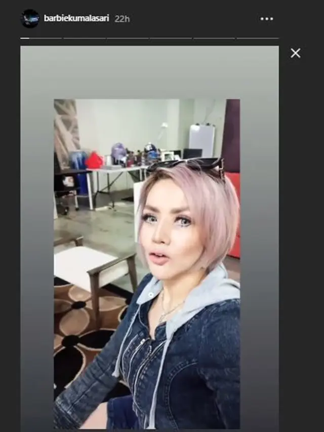 5 Potret Penampilan Terbaru Barbie Kumalasari Pasca Operasi Hidung, Jadi Sorotan