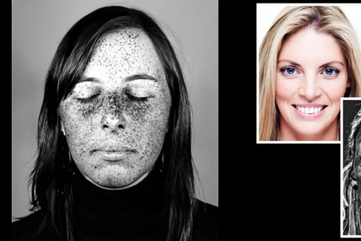 Foto: copyright totalbeauty.com