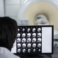 Potret seorang dokter sedang melihat hasil ct scan pasiennya yang penasaran apakah terserang moyamoya atau tidak setelah adanya gejala. (Foto dok: freepik/jcomp).