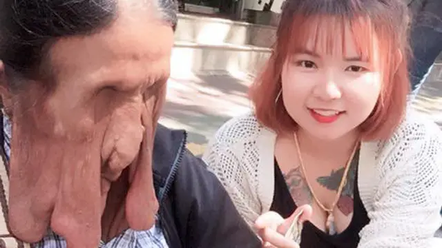Wajahnya Mencair, Ini Alasan Nenek 63 Tahun Tolak Bantuan Medis