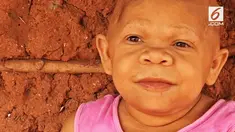 Kondisi ini berawal ketika keluarga mengabaikan gejala dari kelainan medis yang mulai dialami Maria di usia 9 bulan. Alhasil, wanita berusia 37 tahun ini terperangkap dalam tubuh bayi.