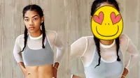 Punya Gigi Ompong, Gadis Ini Sukses Jadi Sosok Tak Terduga