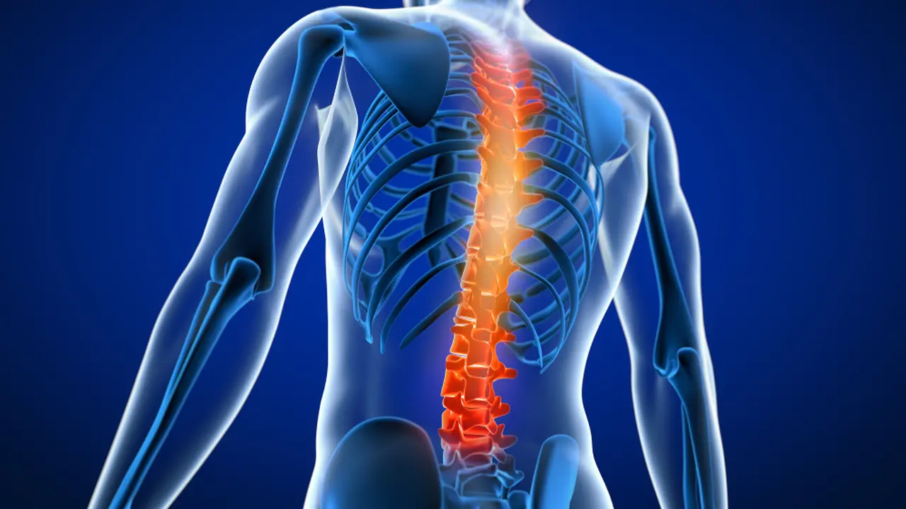 Mengenal Spinal Cord Injury yang Dialami Laura Anna, Cedera Pada Sumsum Tulang Belakang