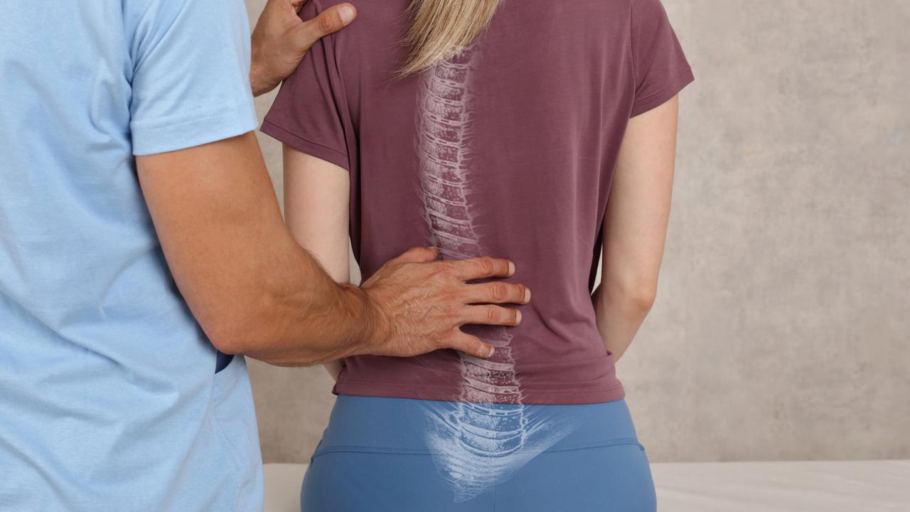 Jangan Anggap Remeh Skoliosis, Ini Langkah Pencegahan dan Penanganan Tepat