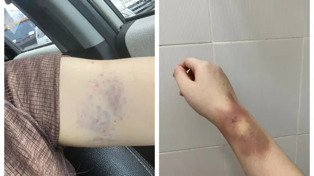 Keponakan Hotman Paris Jadi Korban Dugaan KDRT, Suami Langsung Jadi Tersangka dan Ditahan