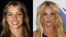 Britney Spears pernah mengaku pada Instyle bahwa dirinya melakukan lip injections. (Rex - Shutterstock - HollywoodLife)