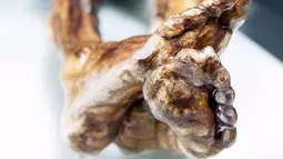 Seorang ilmuwan memeriksa mumi Otzi di Museum Arkeolog EURAC, Bolzano, Italia, (4/1/2016). Penelitian ini menemukan petunjuk baru tentang ilmu kesehatan yang dimililki oleh manusia es ini. (REUTERS / Sudtiroler Archaeologiemuseum)