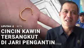 Cincin Kawin Tersangkut di Jari Pengantin