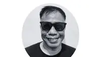 Temon Meninggal karena Serangan Jantung, Abdel Ucapkan Selamat Jalan